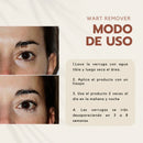 Wart Remover | Removedor de verrugas y lunares