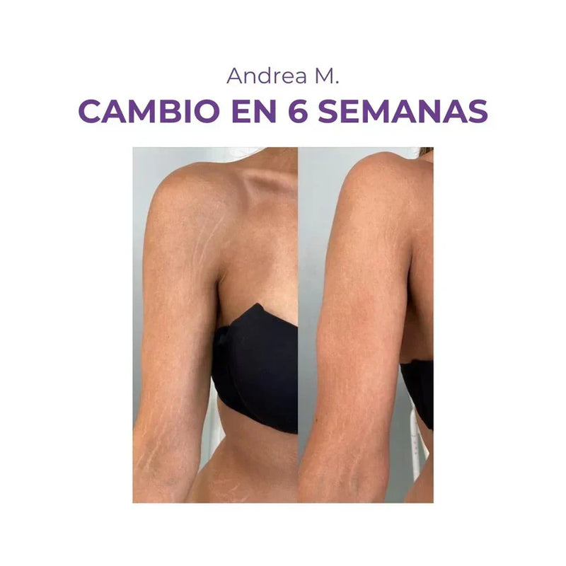 Crema AntiEstrías - EMILY