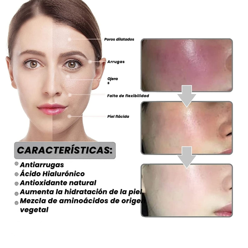 ClearSkin - Serum Quitamanchas - ENVIO GRATIS
