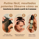 VITASEL™ - Activador Capilar con Células Madre y Factores de Crecimiento