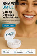 Carillas dentales - Descubre el poder de una sonrisa blanca - OFERTA 3X1