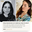 Parches PuraDerma™