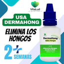 DermaHong Pro™ – Dile Adiós a los Hongos disminuye en 15 Días 🔥 Producto en tendencia